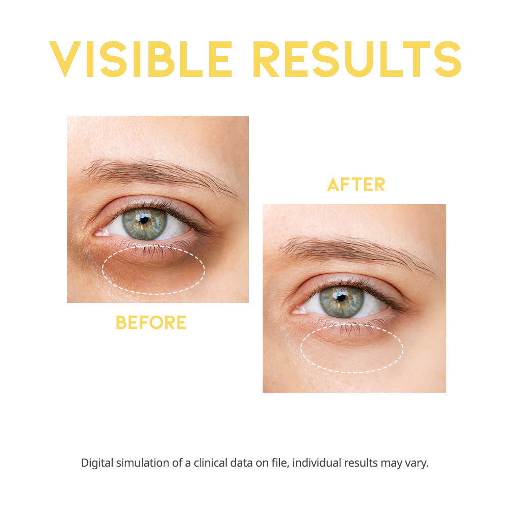 OOTD Dark Circle Eye Serum 30g