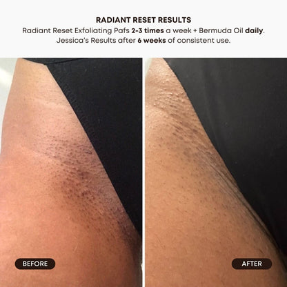 Bushbalm Radiant Reset Exfoliating Toner Pads