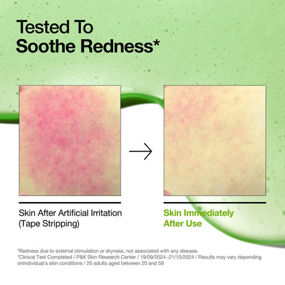 Anua Azelaic Acid 10% Hyaluron Redness Soothing Serum 30ml