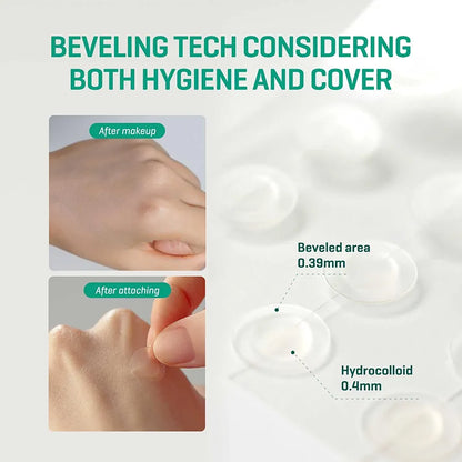 SOME BY MI 30 Days Miracle Clear Spot Patch (18)