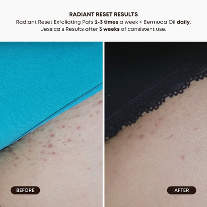 Bushbalm Radiant Reset Exfoliating Toner Pads
