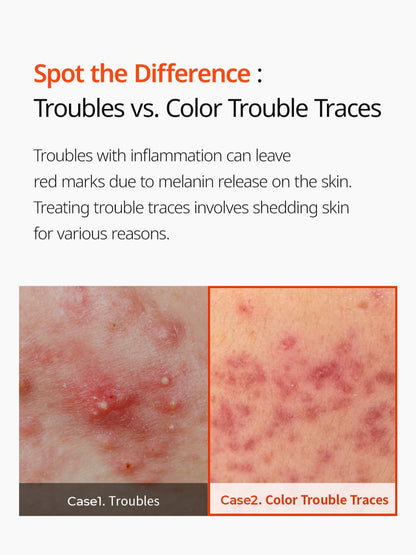 Dr. Melaxin Exosome Repair Toner 300ml